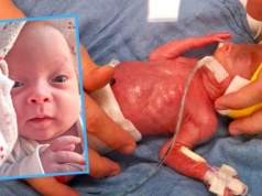 Cud w Opolu! Pola ważyła 450 gramów, a wygrała walkę o życie