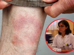 Coraz więcej pacjentów u lekarzy POZ. Nadchodzi armagedon