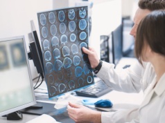 Choroba Alzheimera: są nowe terapie, ale system nie nadąża za postępem. "Chodzi o to, aby takich pacjentów znaleźć"