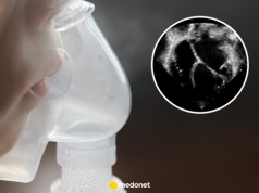 Najpierw pojawił się suchy kaszel. Szanse Maxa na przeżycie wynosiły tylko jeden do trzech