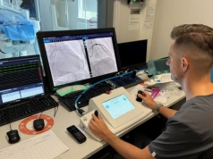 Robot w pracowni hemodynamicznej. UCK w Gdańsku testuje nowe podejście do PCI