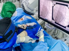 W Gdańsku roboty pomagają lekarzom. „To kamień milowy w kardiologii interwencyjnej”