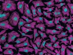 Komórki odpowiedzialne za powstawanie przerzutów u chorych na raka piersi pod lupą naukowców