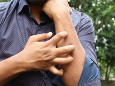 LIszaj płaski - choroba zapalna