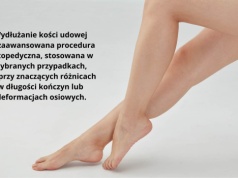 Wydłużanie kości udowej – co warto wiedzieć przed decyzją o zabiegu