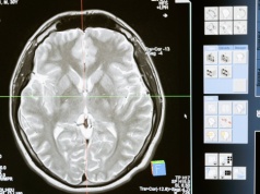 MZ powołuje zespół ds. diagnostyki obrazowej. Będą nowe standardy