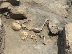 Trepanacja czaszki u 5-latka sprzed 4000 lat. Zaskakujące odkrycie w Uzbekistanie