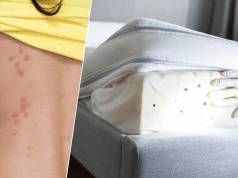 Jak nie przywieźć pluskiew z wakacji? 4 zasady, których warto się trzymać