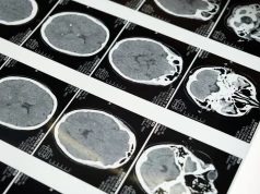 Chiński czip imitujący mózg działa 478 razy szybciej niż Nvidia A100. Może zrewolucjonizować diagnostykę