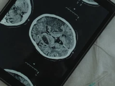 Naukowcy zbadali mózgi osób z depresją. Odkryli zaburzenia neurogenezy