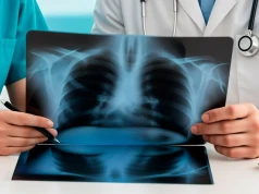 Bezpłatna tomografia płuc bez skierowania. NFZ szykuje start programu na październik