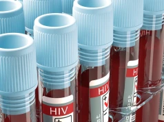 Nowa metoda leczenia HIV. Chodzi o przeciwciała do walki z wirusem