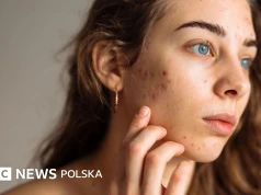 Prosta pielęgnacja skóry dla nastolatków, która naprawdę działa