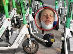 Miała wypadek na hulajnodze elektrycznej. "Chciałam umrzeć"