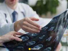 Depresja ma pięć biologicznych profili. Pokazały to badania mózgu