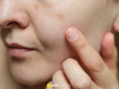 Pogromca starczych plamek w buteleczce. Polki pokochały to kwasowe serum