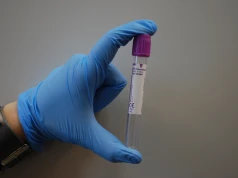 Ciągłe zmęczenie, marznięcie i kilogramy mimo diety. Jedno badanie z krwi za kilkanaście złotych rozstrzyga sprawę