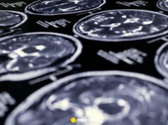 Nagroda Nobla 2026 za przełom w badaniach neurologicznych. "Rewolucyjne możliwości mapowania mózgu"