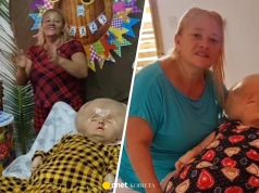 Lekarze nie dawali jej trzech miesięcy życia. Dziś Brazylijka świętuje 33. urodziny