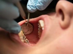 "Upokarzające". Dentystka zniszczyła jej zęby. Tyle przyznał sąd