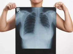 W Polsce codziennie 60 kobiet dowiaduje się o tym nowotworze