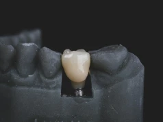 Implant zęba: ile trwa leczenie, ile wymaga wizyt i ile kosztuje