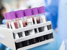 W Polsce brakuje hematologów. Prof. Marcin Pasiarski ostrzega przed problemami z diagnostyką chorób krwi