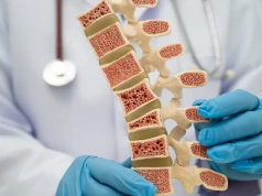 Osteoporoza to nie jest błaha choroba, potrafi zabić. Oto największe mity związane z osteoporozą