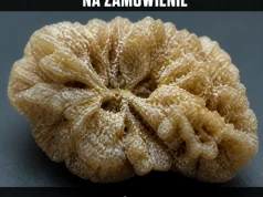 Bakteria odpaliła kamieniołom w nerce
