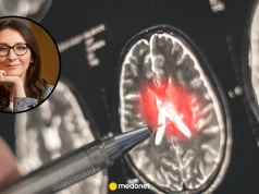 Błędne diagnozy stwardnienia rozsianego. Neurolog potwierdza: to się zdarza