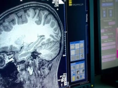 Skan mózgu odkrywa coś dziwnego. Chodzi o zaburzenia psychiczne
