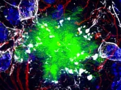 To nieprawda, że nic nie możemy zrobić, by zmniejszyć ryzyko choroby Alzheimera, Parkinsona