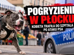 Groźne pogryzienie w Płocku. Kobieta trafiła do szpitala po ataku psa
