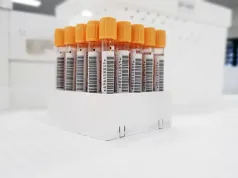 Cukier na czczo w normie, a lekarz i tak zleca kolejne badanie. HbA1c pokazuje, co działo się z glukozą przez ostatnie trzy miesiące
