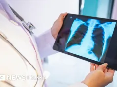 Palenie, rak i AI: najnowsze, ryzykowne przedsięwzięcie Doliny Krzemowej