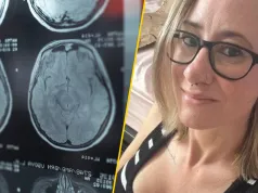 Udar dotyka coraz młodszych pacjentów. Claire: poczułam dreszcz, niemal jakby przeszedł mnie zimny prąd